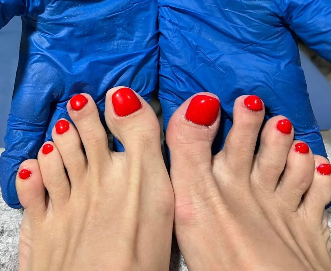 Medical pedicure result